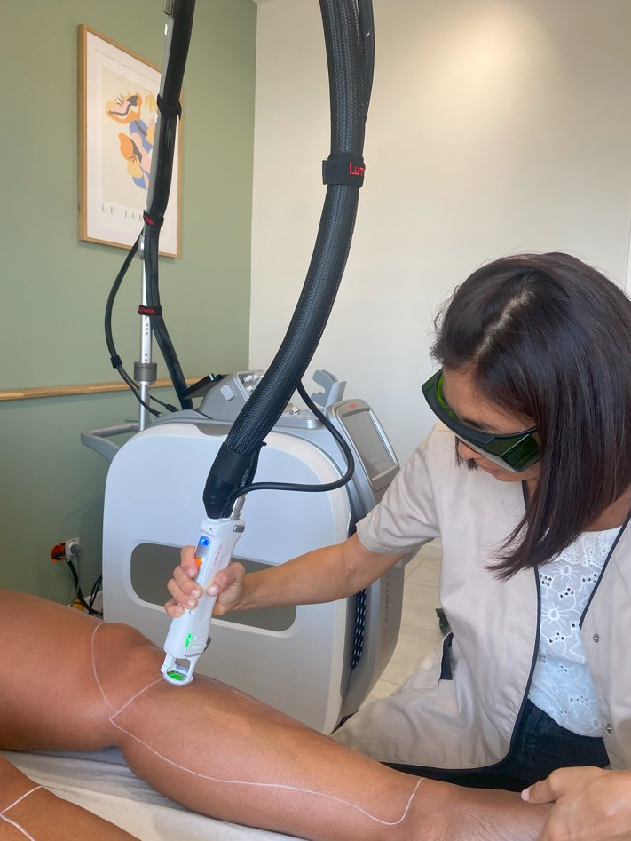 Séance d’épilation au laser Clarity II